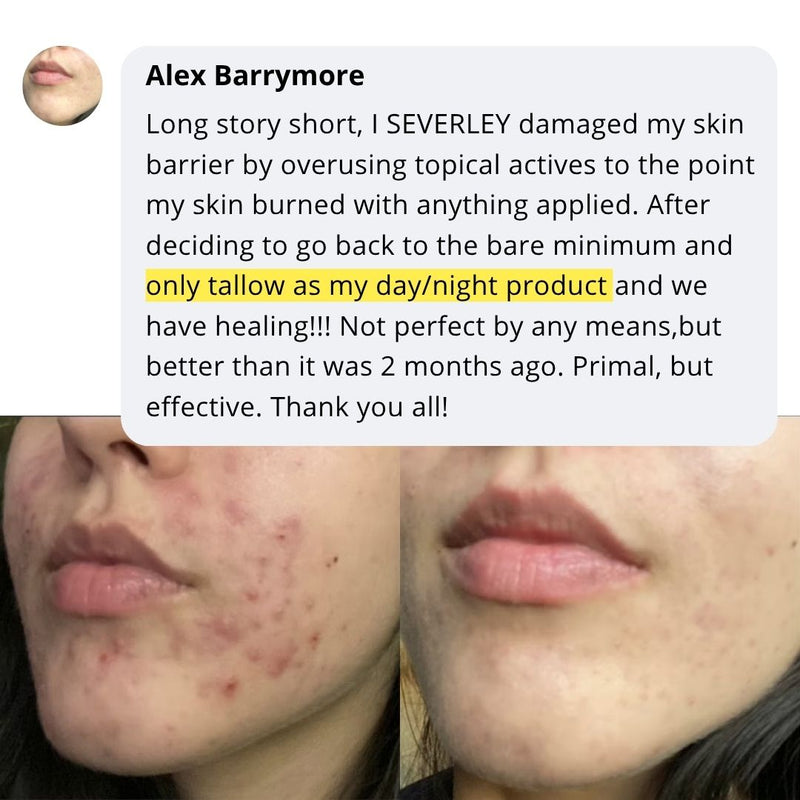 Alex skincare transformation