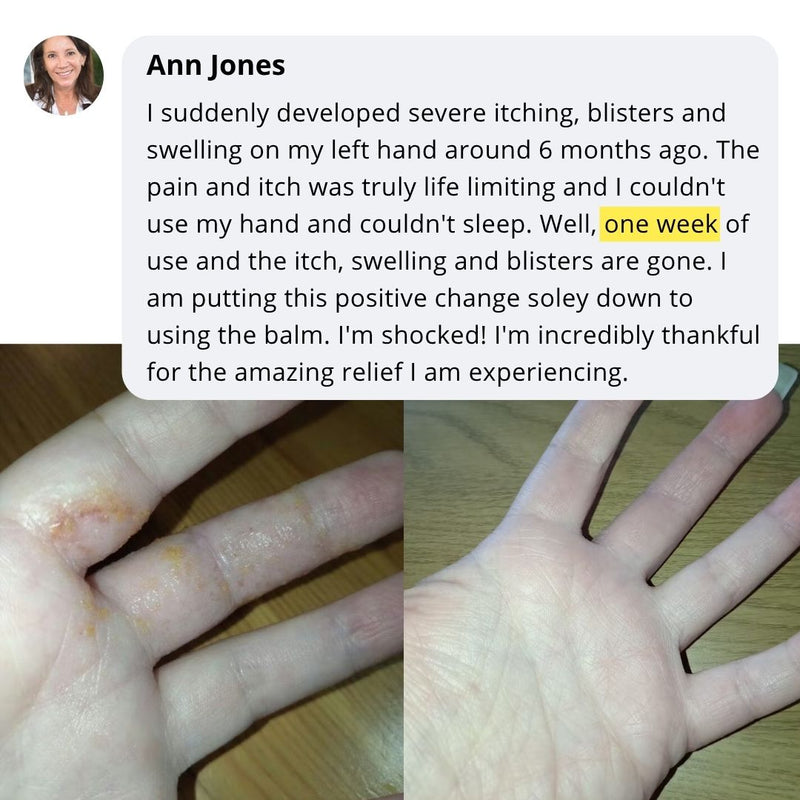 Ann skincare transformation