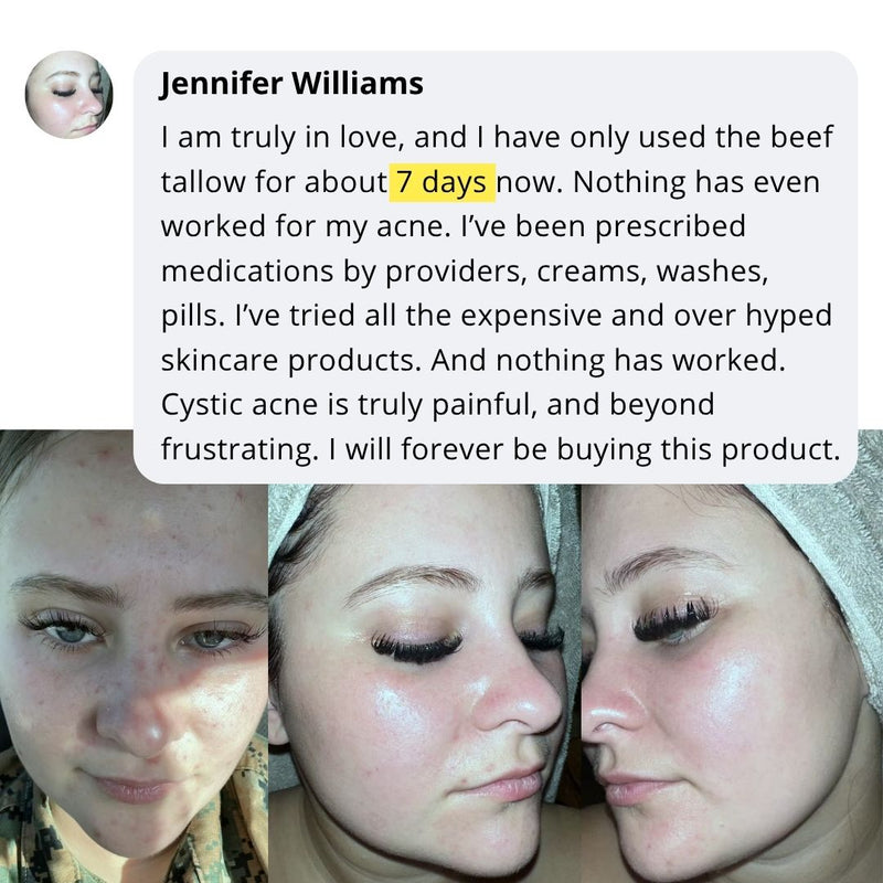 Skincare transformation