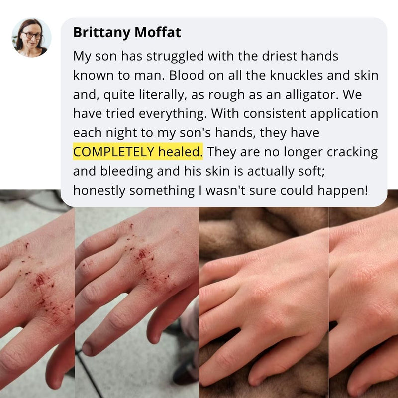 Brittany skincare transformation