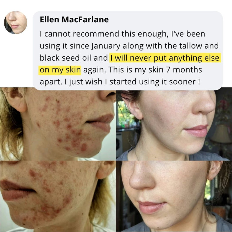 Community skincare routine story