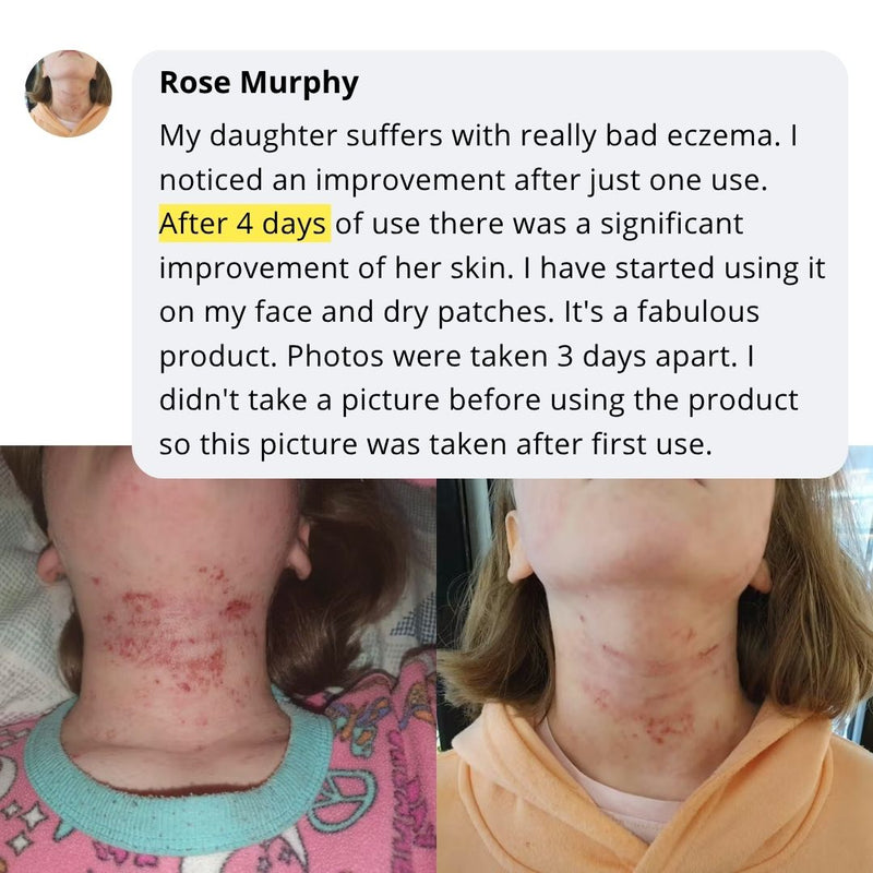 Community skincare routine story