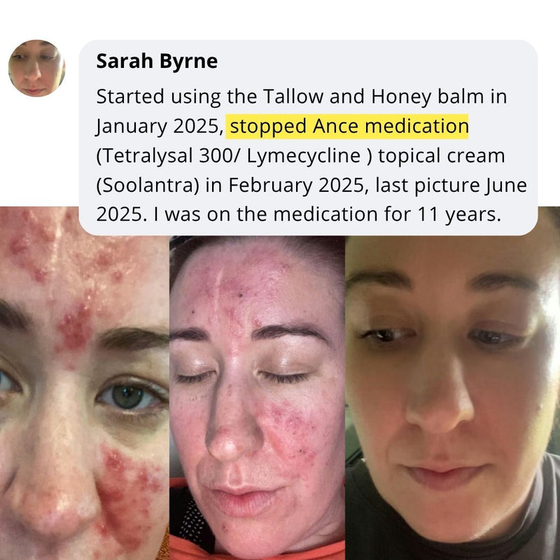 Community skincare routine story